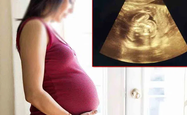 Rare Case: Foetus Found Inside Unborn Baby’s Abdomen