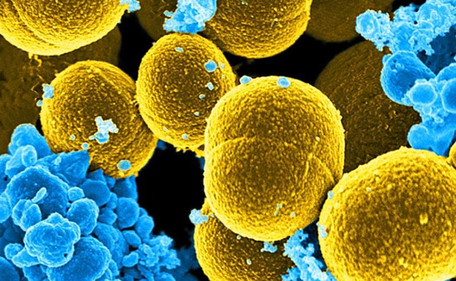 Israeli Discover virus defence system in marine bacteria