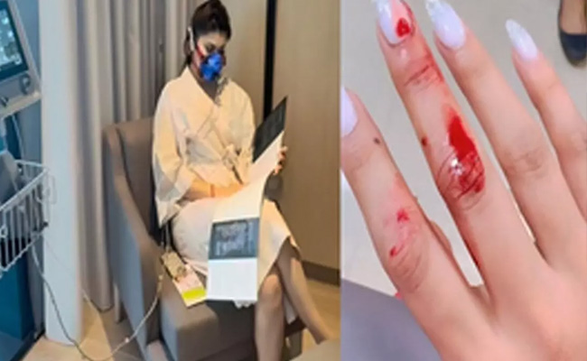 Urvashi Rautela trolled for getting admitted in hospital for a minor cut